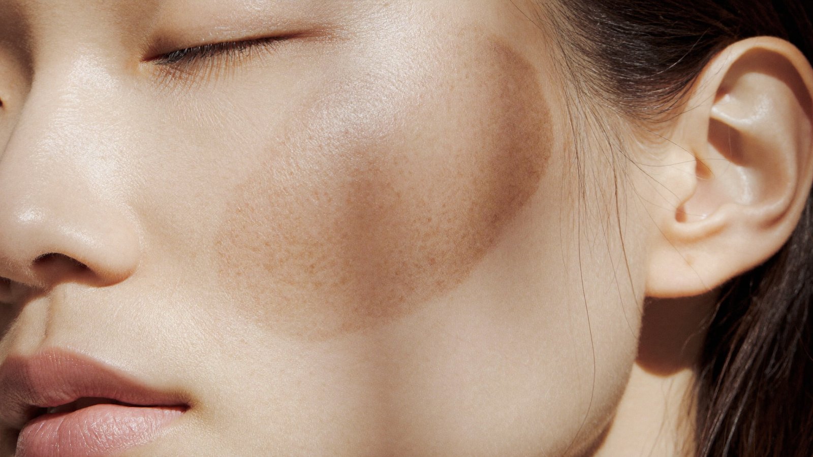 Dr Sin Yong examining facial pigmentation under clinical lighting in Singapore