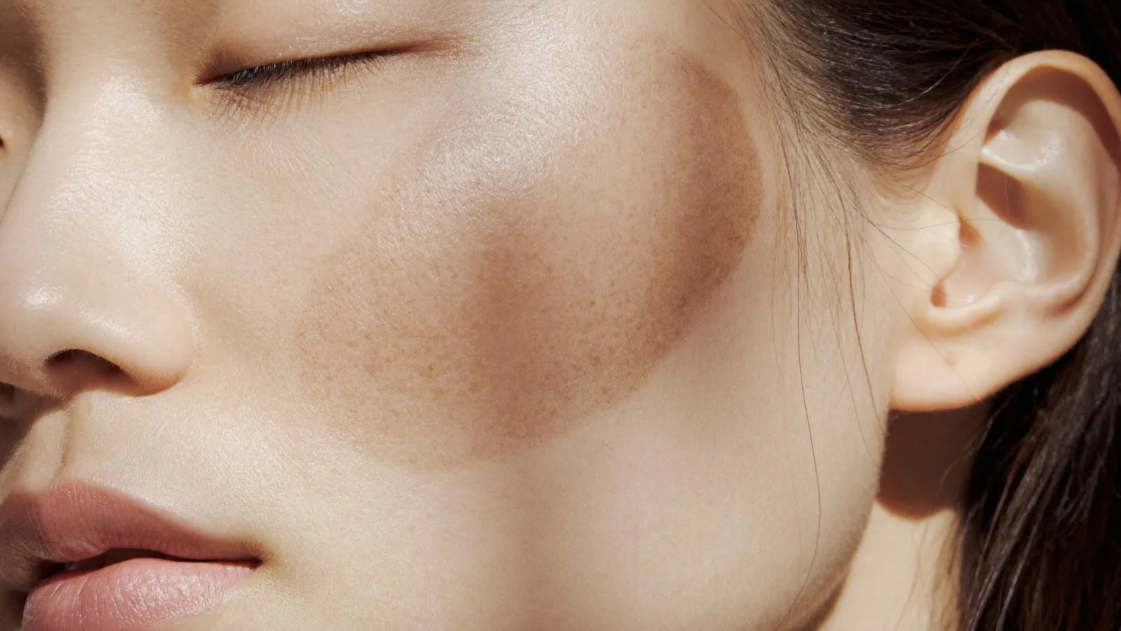Dr Sin Yong examining facial pigmentation to tell freckles apart from sun spots and melasma
