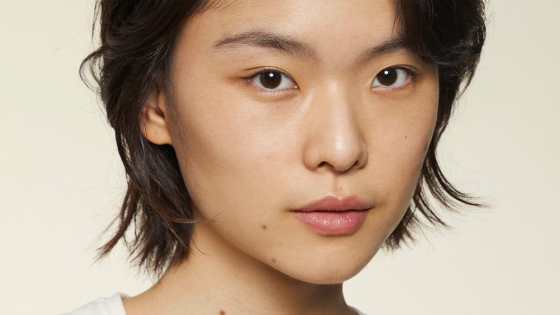 Why I say no to scar treatmentwhile the acne is still active