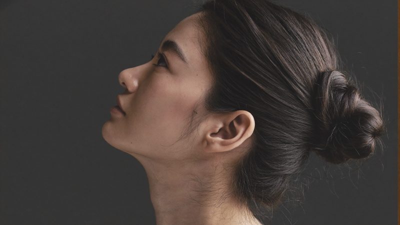 The double chin: four causesthat look identical