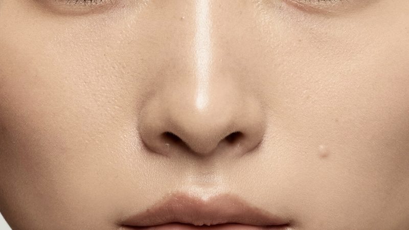 Enlarged pores: nothing shrinks one —here is what honestly changes