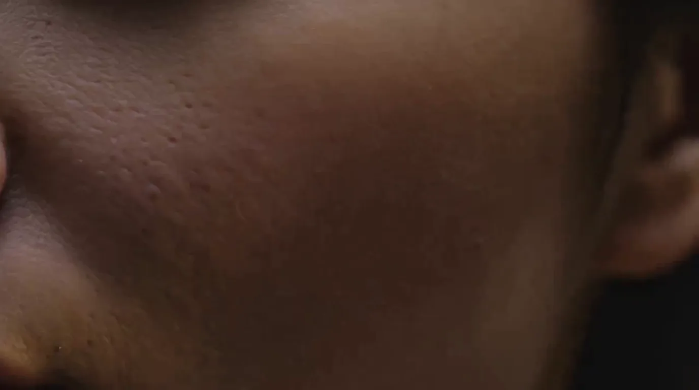 Scar Reconstruction