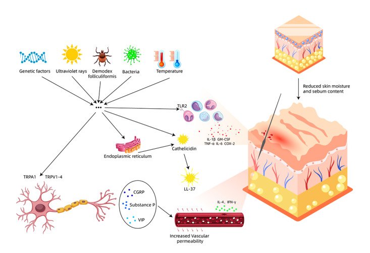 What drives rosacea — the main triggers and pathways behind facial redness