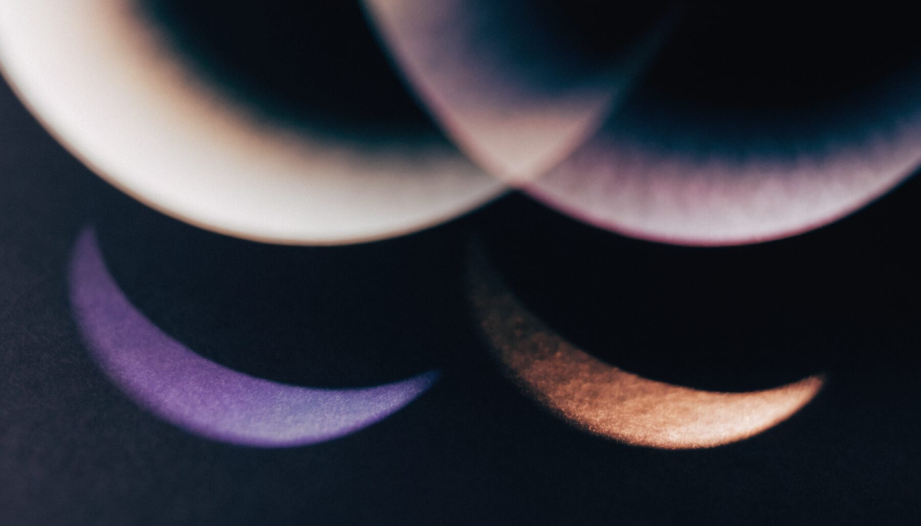 Dark Eye Circles: Which Type Is Yours? &mdash; condition guide by Dr Sin Yong