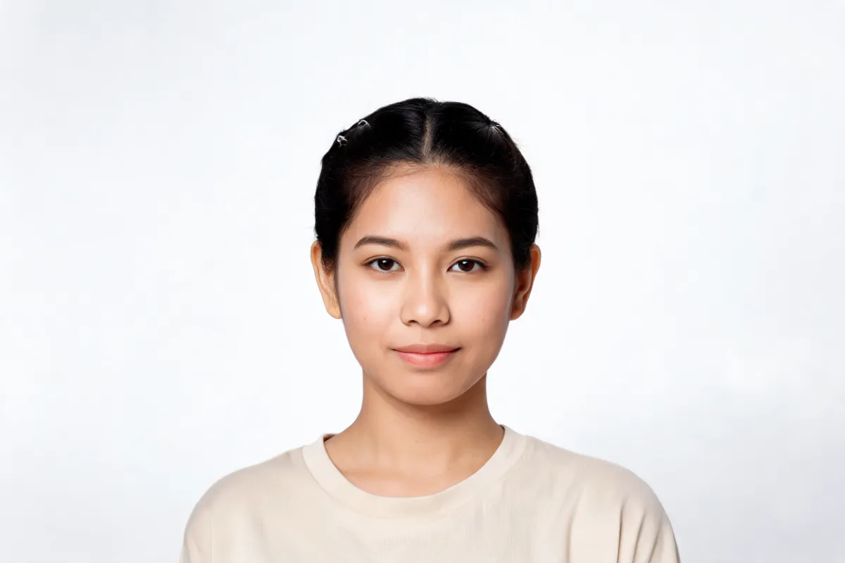 A woman in her twenties with bare skin in soft clean light (illustrative image, not a patient)