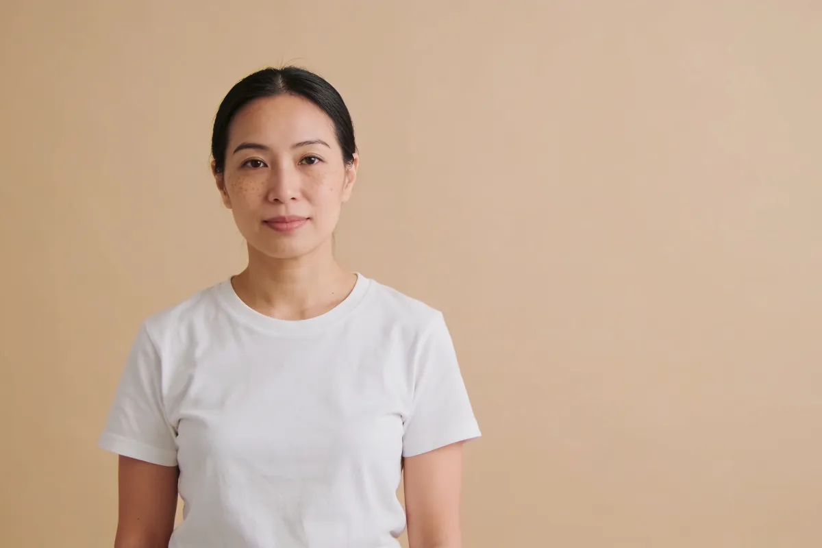 A woman in her thirties with even, bare skin in a white T-shirt (illustrative image, not a patient)
