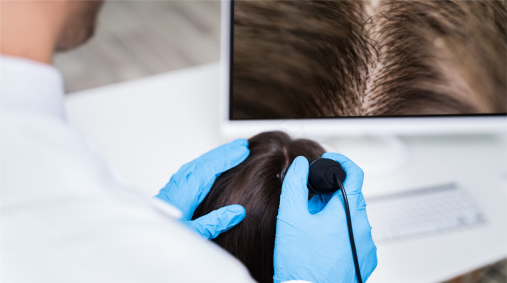 Growth Factors Treatment for Hair Loss | Stem Cell Regeneration