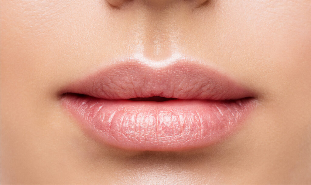 Rekindling The Lips With Lip Fillers